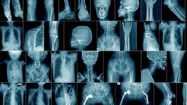 Radiologia diagnostica per immagini e interventistica