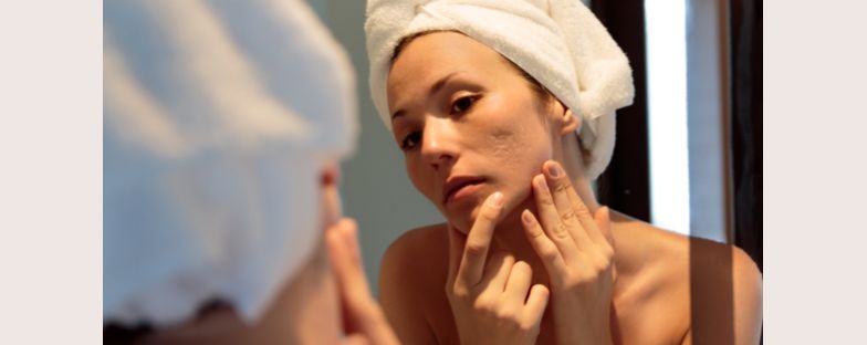 Come trattare le cicatrici da acne