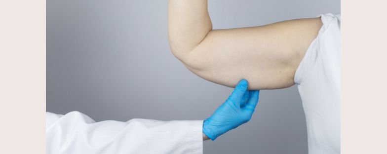 Chirurgia plastica post-bariatrica: a cosa serve e quali sono i principali interventi