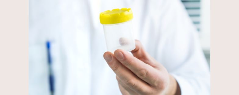 Sangue nelle urine: cause e cure