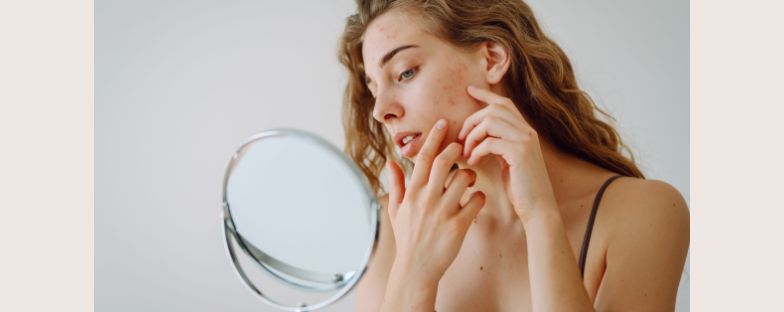 Acne e alimentazione: quali cibi evitare e quali preferire