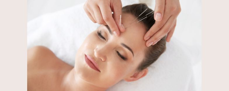 Agopuntura estetica e dermatologica: che cos’è e come funziona 