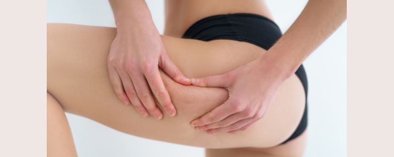 Cos'è la carbossiterapia, il famoso trattamento per la cellulite?
