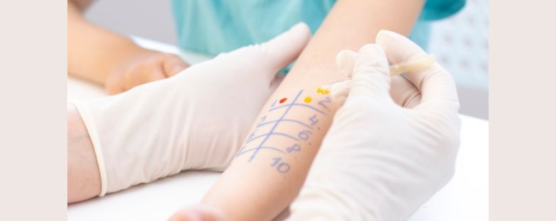 Allergie nei bambini, sintomi e test allergologici