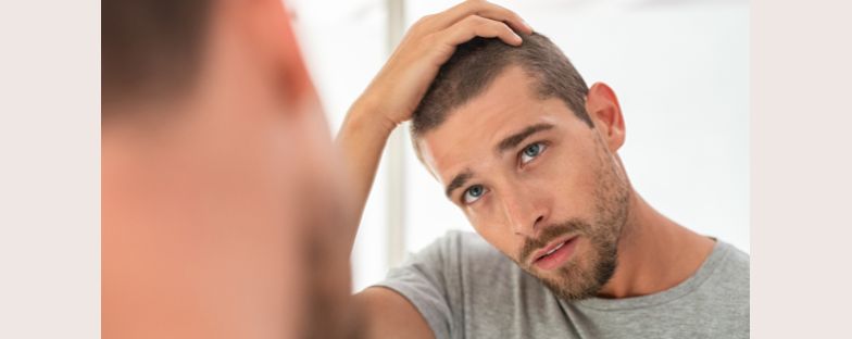 Caduta dei capelli: quali sono le cause e i rimedi