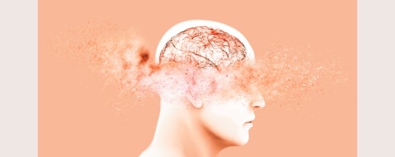 La lunga storia della malattia di Alzheimer tra ricerca e nuove terapie