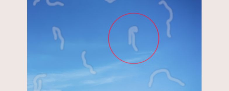 Cosa sono le miodesopsie o mosche volanti negli occhi