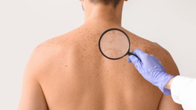 Servizio di dermatologia