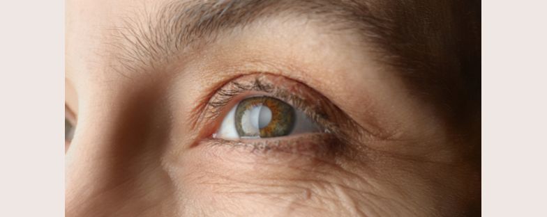 Retinografia e fluorangiografia: 2 esami per la salute dell’occhio